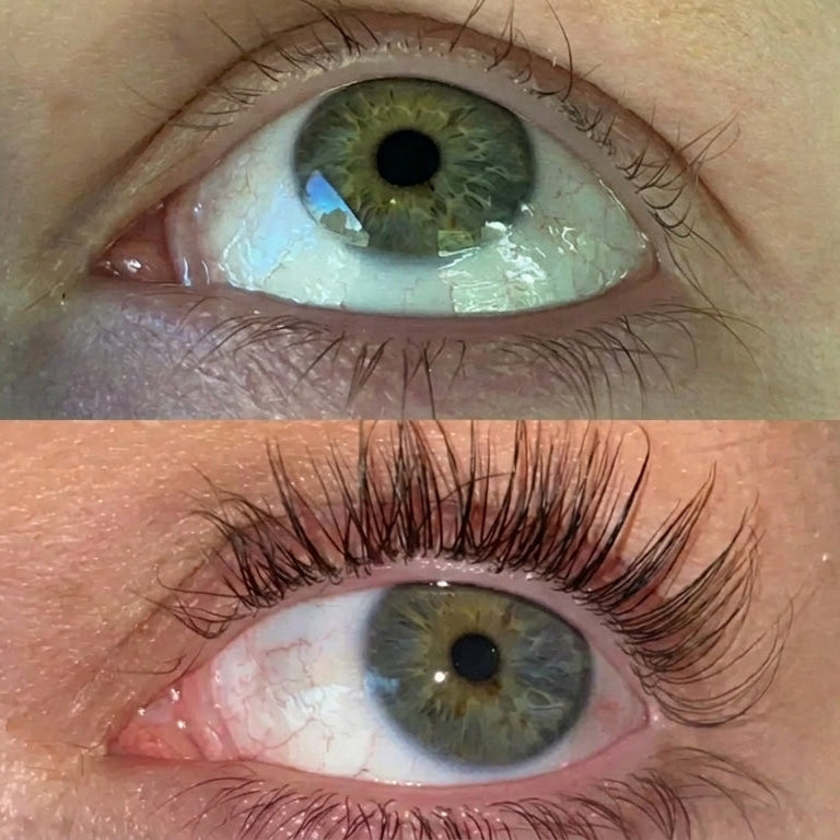 ForChics | EyeLash Serum — Peptide Formula