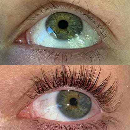 ForChics | EyeLash Serum — Peptide Formula