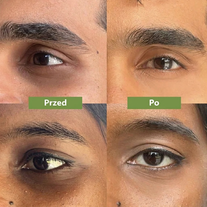 Dr. Melaxin | Eye Bright Corrector
